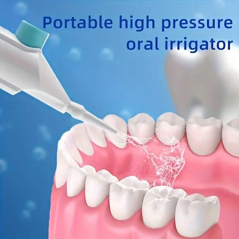 Portable High-Pressure Oral Irrigator – Teeth Cleaning Water Flosser for Home